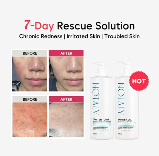 NOTALY TAMITEN TONER